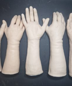 Defective Forearm/Wrist/Hand